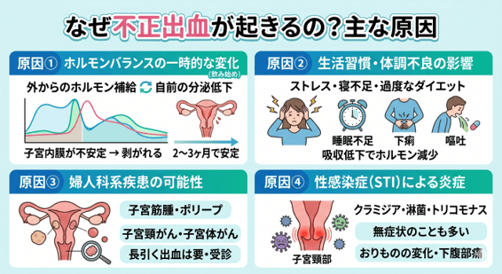 なぜ不正出血が起きるの？