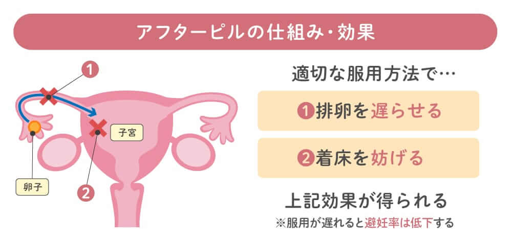アフターピルの仕組み