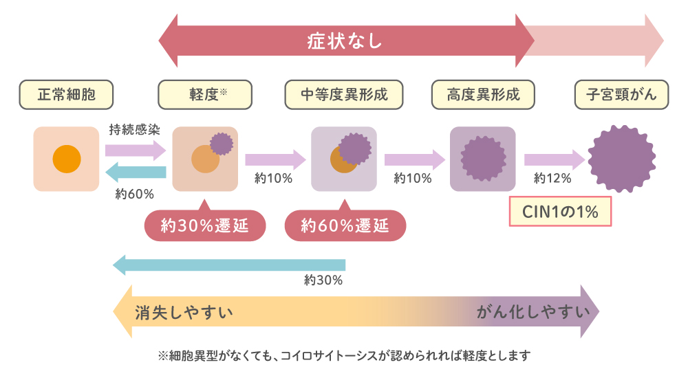 子宮頚がんの状態へと進行する様子