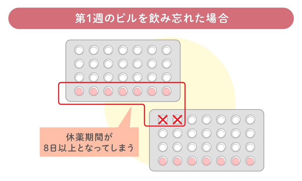 低用量ピル第1週目に飲み忘れた場合