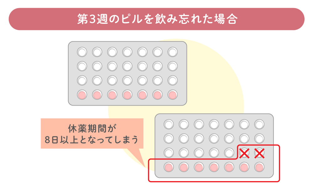 低用量ピル第3週目に飲み忘れた場合