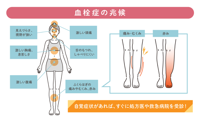 血栓症の兆候